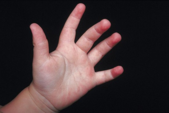 Child's Hand